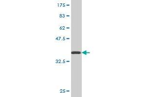 Western Blot detection against Immunogen (36. (ATG5 anticorps  (AA 176-275))