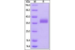 Biotinylated Human BTN1A1, His,Avitag on  under reducing (R) condition.