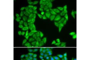 Immunofluorescence analysis of HeLa cells using SPAG5 Polyclonal Antibody (SPAG5 anticorps)
