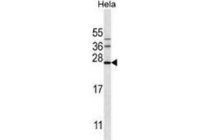 Western blot analysis in Hela cell line lysates (35ug/lane) using Serglycin / PRG1 Antibody (C-term). (SRGN anticorps  (C-Term))