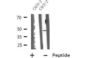 Western blot analysis of HSD17B2 using CACO-2 whole cell lysates (HSD17B2 anticorps  (C-Term))