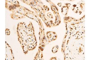 ABIN6267301 at 1/100 staining human placenta tissue sections by IHC-P. (EIF2S1 anticorps  (pSer51))