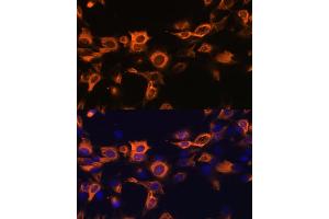 Immunofluorescence analysis of C6 cells using CSF2 antibody (ABIN6130426, ABIN6139094, ABIN6139095 and ABIN6221725) at dilution of 1:100.