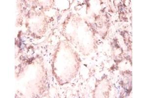 Immunohistochemistry of paraffin-embedded human prostate using. (FGF2 anticorps  (HRP))