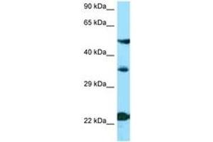 Image no. 1 for anti-Melanocortin 4 Receptor (MC4R) (N-Term) antibody (ABIN6748393) (MC4R anticorps  (N-Term))
