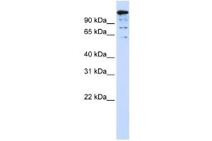 Western Blotting (WB) image for anti-BTB and CNC Homology 1, Basic Leucine Zipper Transcription Factor 2 (BACH2) antibody (ABIN2458413) (BACH2 anticorps)