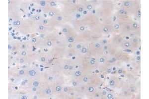 Detection of MMP3 in Human Liver Tissue using Monoclonal Antibody to Matrix Metalloproteinase 3 (MMP3) (MMP3 anticorps  (AA 363-477))