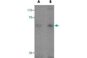 Western blot analysis of TICAM1 in human lung tissue lysates with TICAM1 polyclonal antibody  at (A) 2 and (B) 4 ug/mL . (TICAM1 anticorps  (C-Term))