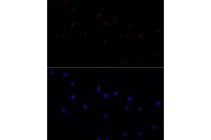 Immunofluorescence analysis of L929 cells using C antibody (ABIN7266034) at dilution of 1:100. (Calpain 7 anticorps  (AA 20-220))