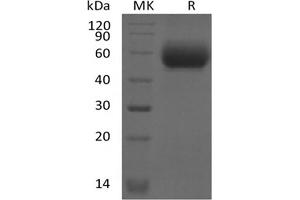 Western Blotting (WB) image for Interleukin 1 Receptor-Like 2 (IL1RL2) protein (His tag) (ABIN7320889)
