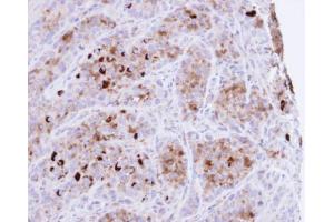 IHC-P Image Immunohistochemical analysis of paraffin-embedded A549 xenograft , using CRHSP-24, antibody at 1:100 dilution. (CARHSP1 anticorps)