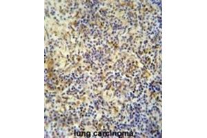 Immunohistochemistry (IHC) image for anti-KRI1 Homolog (KRI1) antibody (ABIN2995581) (KRI1 anticorps)
