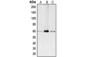 Western blot analysis of BMP2 expression in Caco2 (A), HepG2 (B), THP1 (C) whole cell lysates. (BMP2 anticorps  (Center))