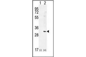 Western blot analysis of HMOX1 (arrow) using Heme oxygenase 1 / HMOX1 Antibody (Center) Cat. (HMOX1 anticorps  (Middle Region))