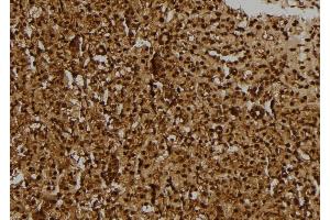 ABIN6275163 at 1/100 staining Rat kidney tissue by IHC-P. (GIDRP88 anticorps  (C-Term))