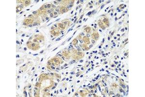 Immunohistochemistry of paraffin-embedded Human stomach using GPRC5A Polyclonal Antibody at dilution of 1:100 (40x lens). (GPRC5A anticorps)