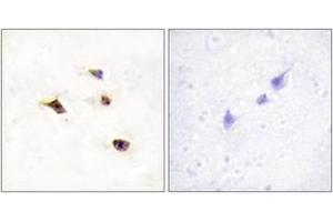 Immunohistochemistry analysis of paraffin-embedded human brain tissue, using IP6K3 Antibody. (IP6K3 anticorps  (AA 201-250))