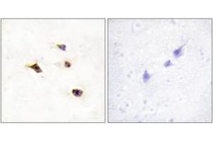 Immunohistochemistry analysis of paraffin-embedded human brain tissue, using IP6K3 Antibody.