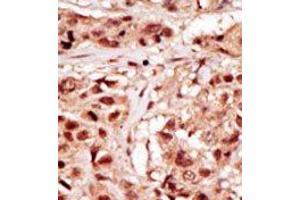 Image no. 2 for anti-TP53 Regulating Kinase (TP53RK) (Middle Region) antibody (ABIN360571) (TP53RK anticorps  (Middle Region))