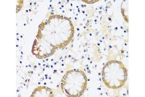 Immunohistochemistry of paraffin-embedded Human stomach using CAMK1 Polyclonal Antibody at dilution of 1:100 (40x lens).