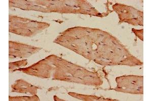 Immunohistochemistry of paraffin-embedded human skeletal muscle tissue using ABIN7172082 at dilution of 1:100 (CDKAL1 anticorps  (AA 1-97))