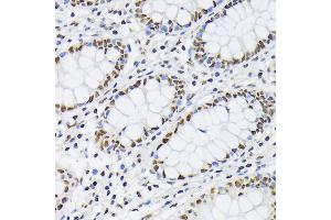 Immunohistochemistry of paraffin-embedded human colon using PTBP1 antibody  at dilution of 1:100 (40x lens).