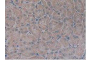 IHC-P analysis of Rat Kidney Tissue, with DAB staining. (Growth Hormone Receptor anticorps  (AA 353-588))