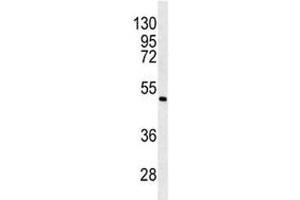 Western blot analysis of ANGPTL6 antibody and K562 lysate.