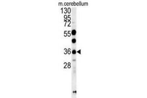 Western Blotting (WB) image for anti-OTU Domain Containing 6B (OTUD6B) antibody (ABIN3002448) (OTUD6B anticorps)