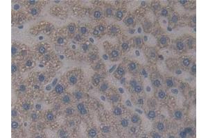 Detection of PXN in Rat Liver Tissue using Polyclonal Antibody to Paxillin (PXN)