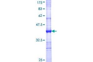 Image no. 1 for Toll-Like Receptor 6 (TLR6) (AA 201-300) protein (GST tag) (ABIN1322884)