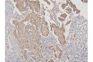 IHC analysis of RNF123 using anti-RNF123 antibody (ABIN6719387).