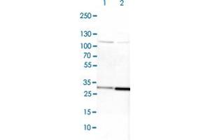 Western blot analysis of Lane 1: NIH-3T3 cell lysate (Mouse embryonic fibroblast cells) Lane 2: NBT-II cell lysate (Rat Wistar bladder tumour cells) with CYC1 polyclonal antibody  at 1:100-1:250 dilution. (Cytochrome C1 anticorps)