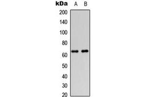 Western blot analysis of DGK epsilon expression in HeLa (A), HEK293T (B) whole cell lysates. (DGKE anticorps  (Center))