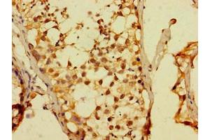 Immunohistochemistry of paraffin-embedded human testis tissue using ABIN7150619 at dilution of 1: 100 (DUX4 anticorps  (AA 217-402))