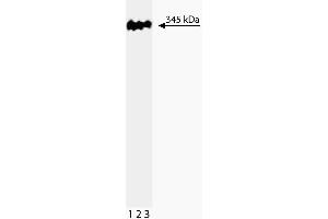 Western blot analysis of 53BP1 on a HeLa lysate. (TP53BP1 anticorps  (AA 149-259))