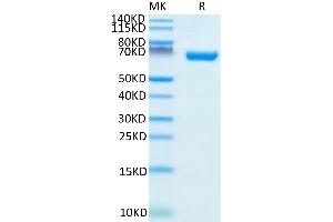 Human CD38 on Tris-Bis PAGE under reduced condition. (CD38 Protein (AA 43-300) (Fc Tag))