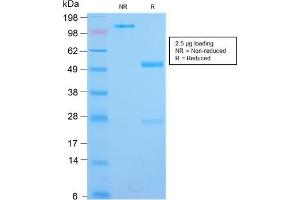 SDS-PAGE Analysis Purified IL3RA Rabbit Recombinant Monoclonal Antibody (IL3RA/2947R). (Recombinant IL3RA anticorps  (AA 26-171))