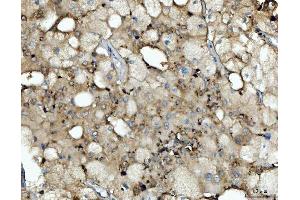IHC analysis of Cathepsin B/CTSB using anti-Cathepsin B/CTSB antibody (ABIN7601692).