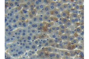 IHC-P analysis of Mouse Liver Tissue, with DAB staining. (ANG anticorps  (AA 25-145))