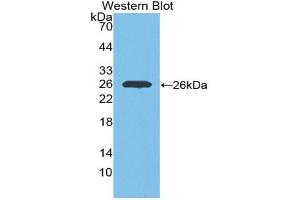 Western blot analysis of the recombinant protein. (IGF1R anticorps  (AA 763-955))