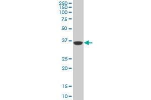 Western Blotting (WB) image for anti-PDZ Binding Kinase (PBK) (AA 1-110) antibody (ABIN599274) (PBK anticorps  (AA 1-110))