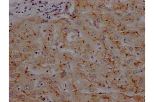 IHC image of ABIN7127393 diluted at 1:100 and staining in paraffin-embedded human liver tissue performed on a Leica BondTM system. (Recombinant CD13 anticorps)
