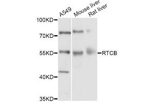 Western blot analysis of extracts of various cell lines, using RTCB Antibody (ABIN5998730) at 1/1000 dilution. (C22orf28 anticorps)