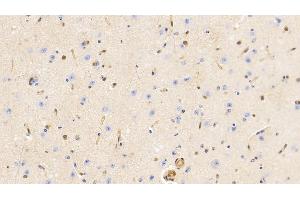 Detection of GSN in Bovine Cerebrum Tissue using Monoclonal Antibody to Gelsolin (GSN)