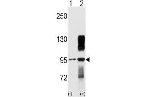 Western blot analysis of TYRO10 (arrow) using rabbit polyclonal TYRO10 Antibody. (DDR2 anticorps)