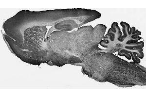 Adult rat brain immunohistochemistry. (ARL6 anticorps  (AA 1-186))