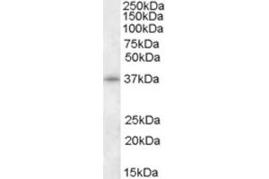 Western Blotting (WB) image for anti-Cyclin-Dependent Kinase 10 (CDK10) (N-Term) antibody (ABIN2466821)