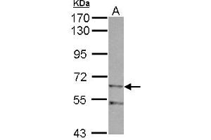 Western Blotting (WB) image for anti-Zinc Finger, Imprinted 2 (ZIM2) (AA 271-490) antibody (ABIN1501825) (ZIM2 anticorps  (AA 271-490))