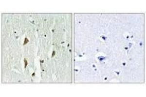 Immunohistochemistry analysis of paraffin-embedded human brain tissue using PAK1/2/3 (Ab-423/402/421) antiobdy.